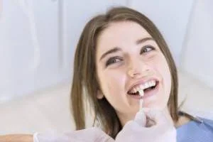 اصلاح طرح لبخند