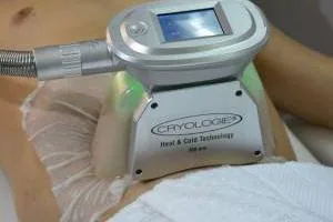 کرایو لیپولیز