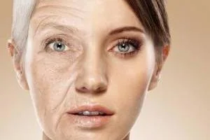پیری زودرس