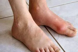 تشخیص بیماری از پا