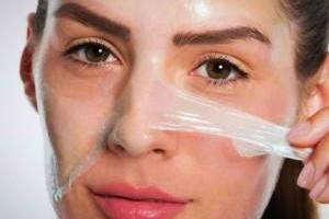 عوارض لایه برداری