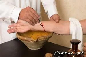 فصد خون