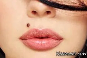 خال خطرناک