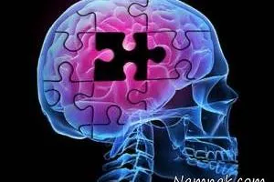 آلزایمر