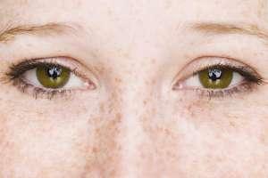 پاک کردن لک و مک صورت