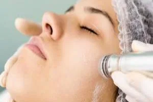 دستگاه میکرودرم