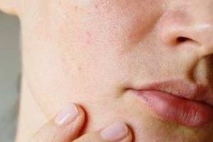 منافذ باز پوست