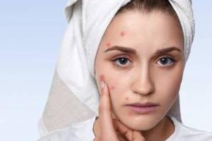 مشکلات پوست و موی