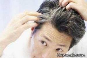 سفید شدن مو