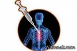 بی حسی اپیدورال