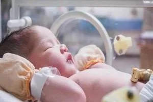 روز نوزاد نارس