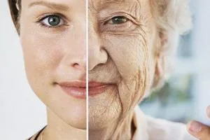 پیری زودرس پوست