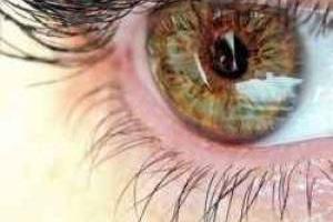 درمان خشکی چشم