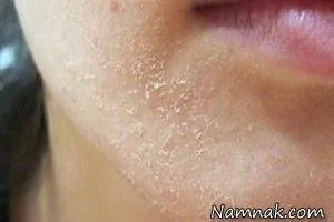 درخواست های بدن