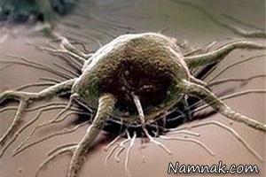 سرطان گوارش