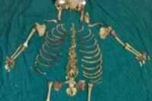 اسکلت جنین