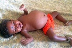 اعضای بدن جنین