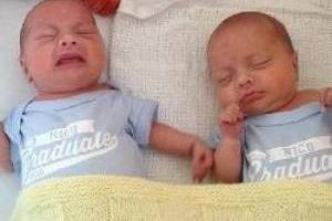 نوزاد دوقلو