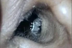عنکبوت گوش 