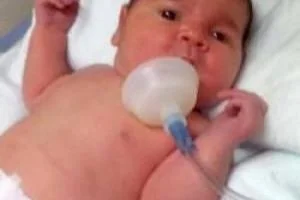 تولد نوزاد بزرگ