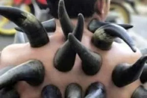حجامت با شاخ