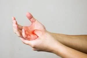 فیبرومیالژیا