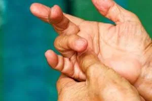 انگشت ماشه ای