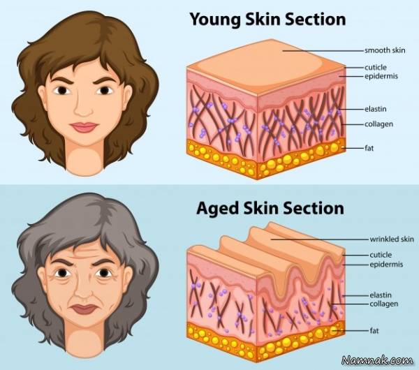 درمان چروک پوستی
