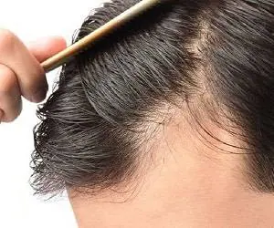 سلامت مو