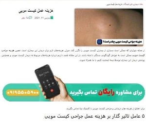 هزینه عمل کیست مویی