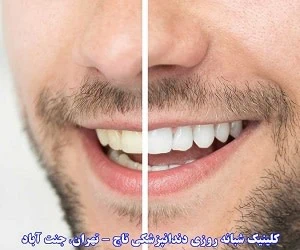 لبخند زیبا