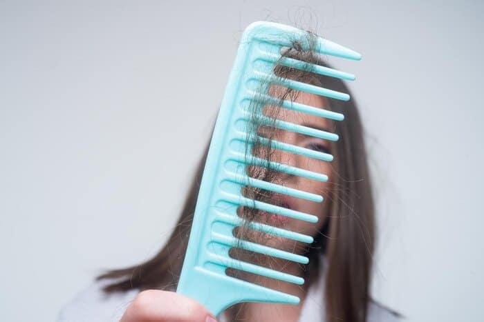 درمان ریزش مو