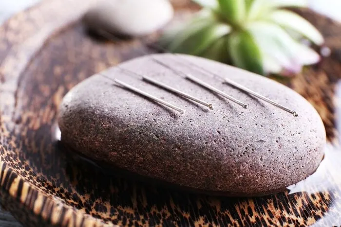 کم کردن وزن با طب سوزنی