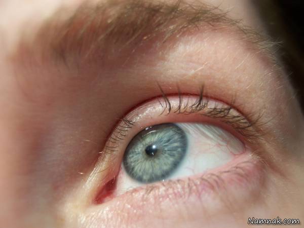 علل ریزش مژه چشم