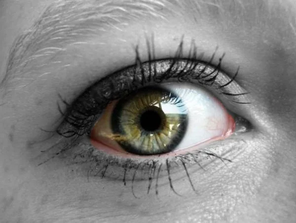 حلقه اطراف عنبیه چشم