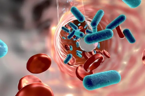 Anemia