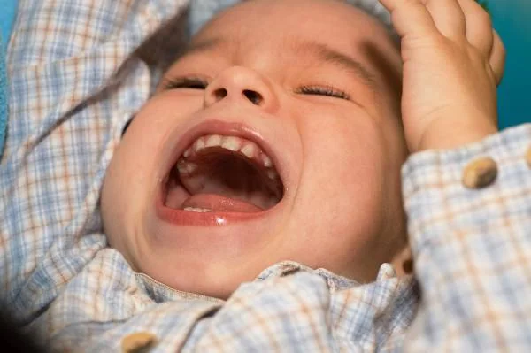 نشانه های هیدروسفالی