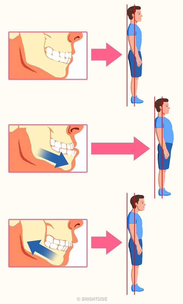 علت قوز کمر 