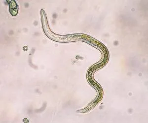 نشانه انگل