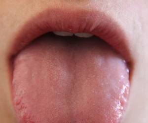 نشانه سرطان روی زبان