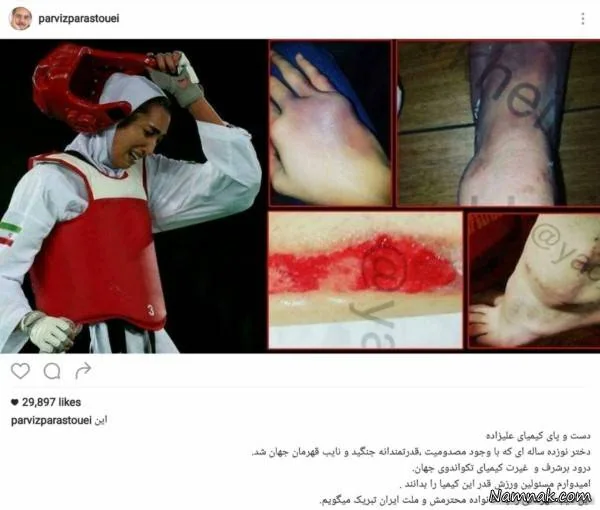 کیمیا علیزاده