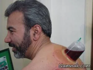 حجامت
