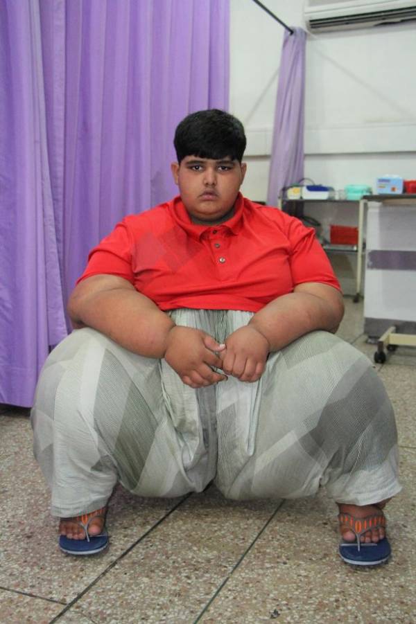 چاق ترین پسر بچه جهان + عکس های عجیب
