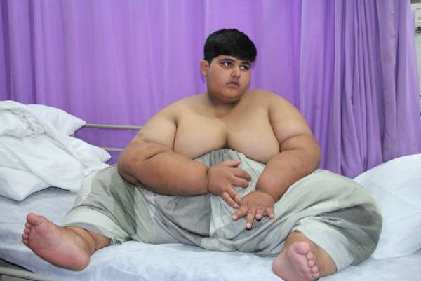 چاق ترین پسر بچه جهان + عکس های عجیب