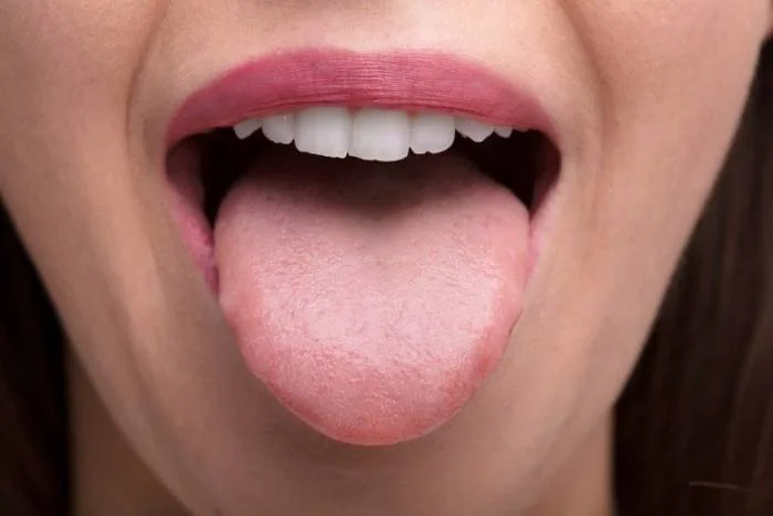برفک زدن دهان