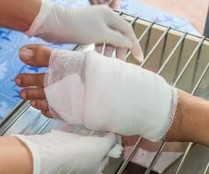 درمان قانقاریا