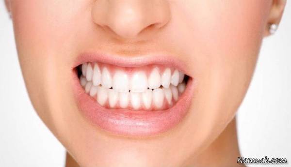 علت دندان قروچه 