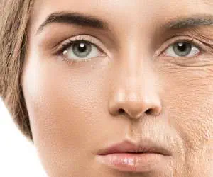 افتادگی پوست صورت