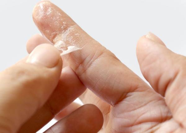 طریقه پاک کردن چسب از روی دست