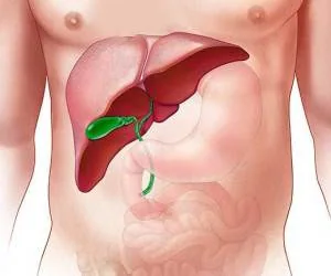 پاکسازی گیاهی کبد